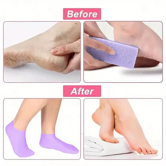 Chaussettes hydratantes pour les pieds, chaussettes en silicone pour les pieds secs et gercés, chaussettes pour femmes pour hydrater et masser