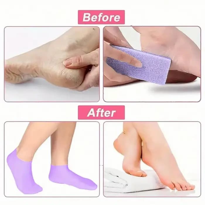 1 paire de chaussettes en Silicone pour femmes
