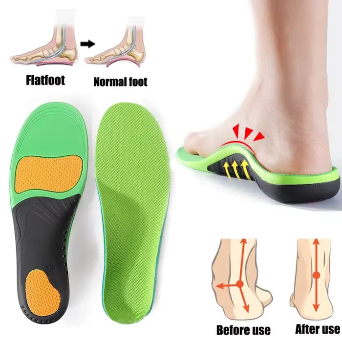 Semelles Orthopédiques Support de Voûte Plantaire de Sport Semelles Orthopédiques de Pied Plat pour Chaussures Femmes Hommes Coussinet de Pied de Voûte Plantaire X / O Coussinets de Correction de Jamb