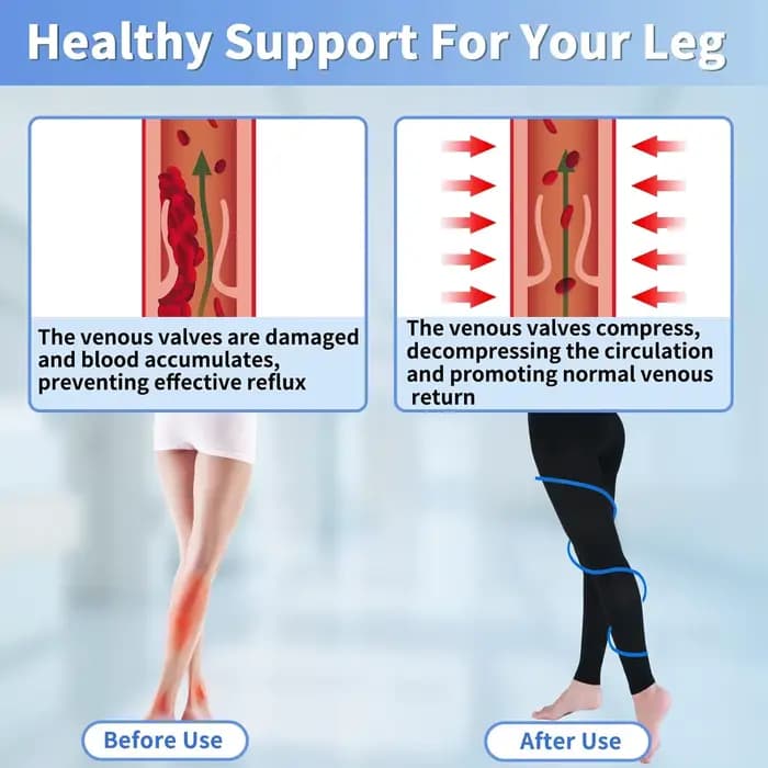 Collants de Compression médicaux 22-32mmHg